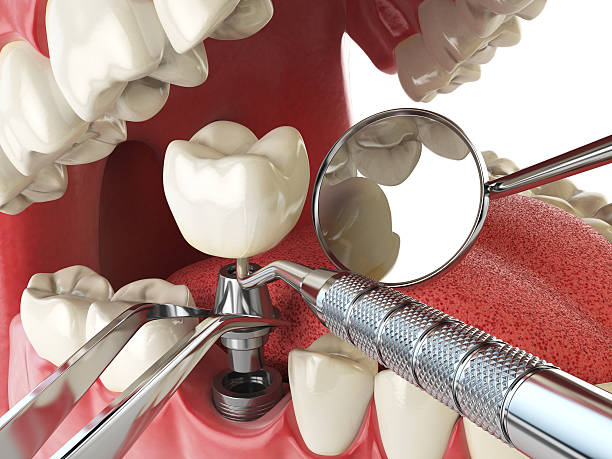 Best Urgent Dental Care for Toothaches in Borger, TX